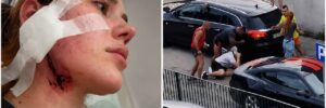 Напали через український акцент: у Польщі жорстоко побили молоду пару