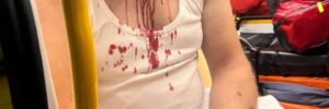 У Польщі напали на трьох українців: жахливі кадри