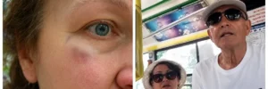 “То навіщо вас тоді захищати?”: На Львівщині через російську мову жорстоко побили матір військового (ВІДЕО)